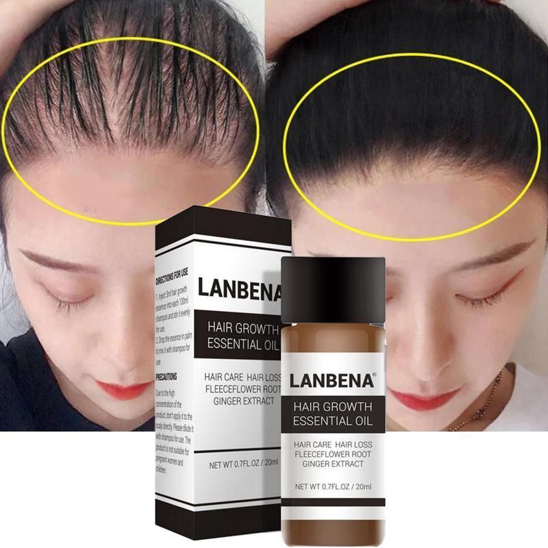 Lanbena Hair Growth Essential Oil Mengatasi Rambut Rontok &amp; Mencegah Kebotakkan / Minyak Memperkuat Akar Rambut / Minyak Penumbuh Rambut / Minyak Penyubur Rambut / Minyak Pelebat Rambut / Minyak Perawatan Rambut Rontok &amp; Botak /Serum Penumbuh Rambut Ampuh