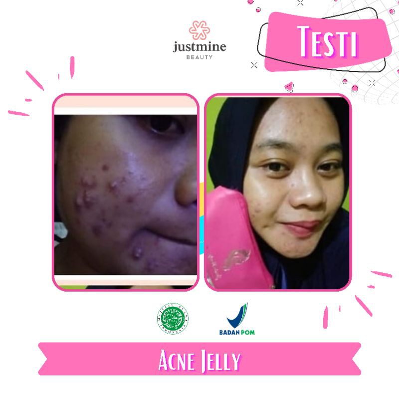 Paket isi 4 Justmine Beauty Skincare All Varian Series - Paket Night Glow Remove Spot AcneJelly
