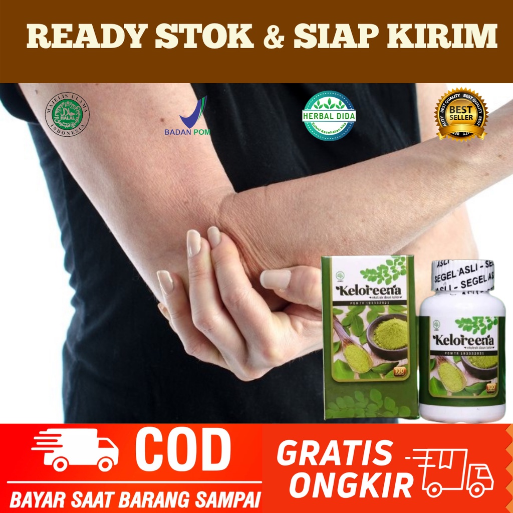 Obat Nyeri Tulang Sikut, Obat Sakit Sikut, Obat Herbal Nyeri Tulang Sikut, Obat Radang Siku Tangan, 