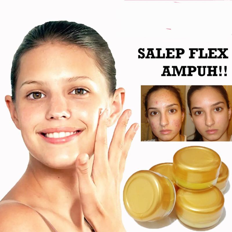 SALEP FLEX HITAM MELASMA AMPUH /  Salep Wajah Untuk Menghilangkan Flex Hitam