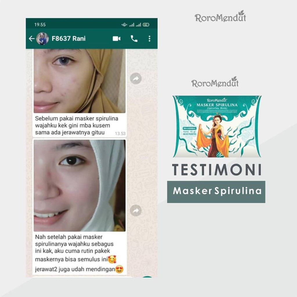 Roro Mendut Masker Spirulina Whitening / Anti Acne / Komedo / Bopeng 20gr &amp; 40gr