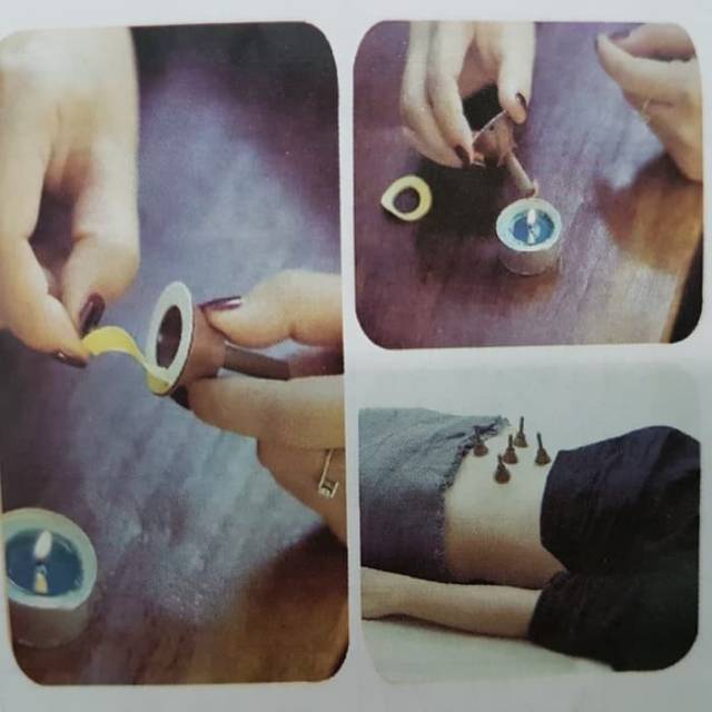 Akupuntur Moxa Mini Moksa Asap Isi 60 Pcs
