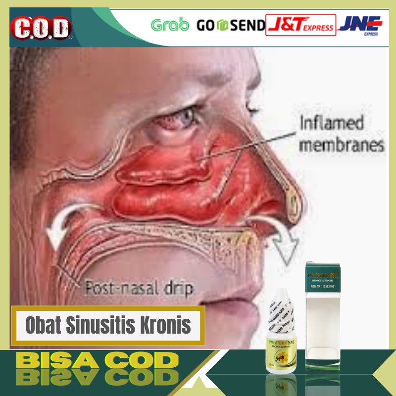 Obat Sinusitis Kronis Propolis SM Brazillian 100% Original BPOM