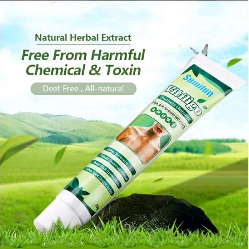 Sumifun Cream Salep Vitiligo Antibakteri