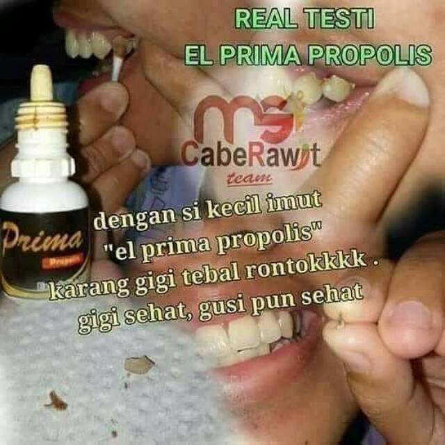 Perontok karang gigi, El prima propolis MSI original.