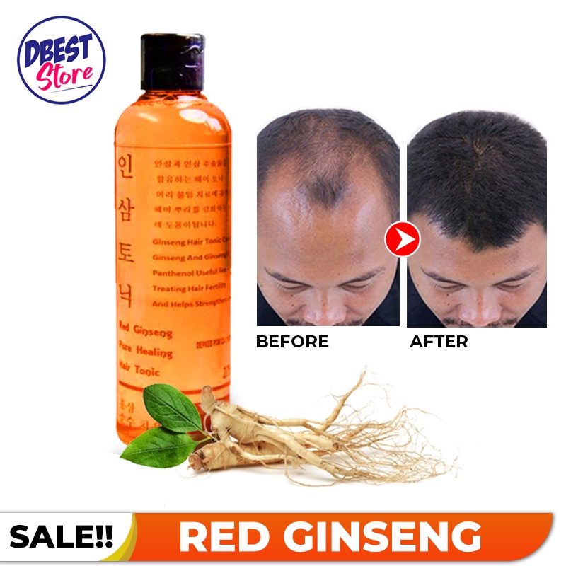 TERMURAH! RED GINGSENG HAIR TONIC ORIGINAL / Tonic Penumbuh Rambut dan Mencegah Kerontokkan