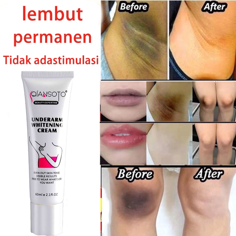 cream pemutih ketiak pemutih selangkangan pencerah selangkangan 60g/ml pemutih ketiak dan selangkangan ampuh pencerah selangkangan Lembut tidak menyebabkan iritasi permanen