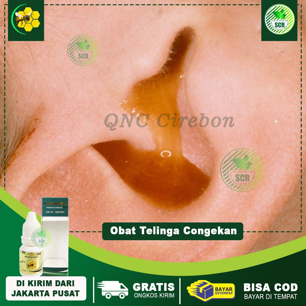 Jual Obat Congek Curek Telinga Bernanah Bau Telinga Berair Obat