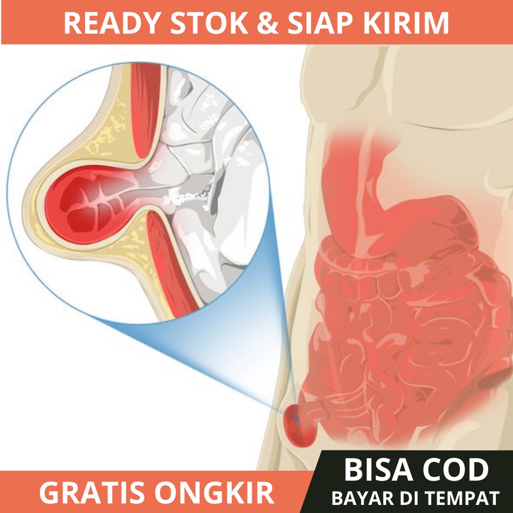 Obat Hernia Turun Berok Buah Zakar Besar Sebelah Turun Peranakan Hidrokel Varikokel Testis Bengkak H