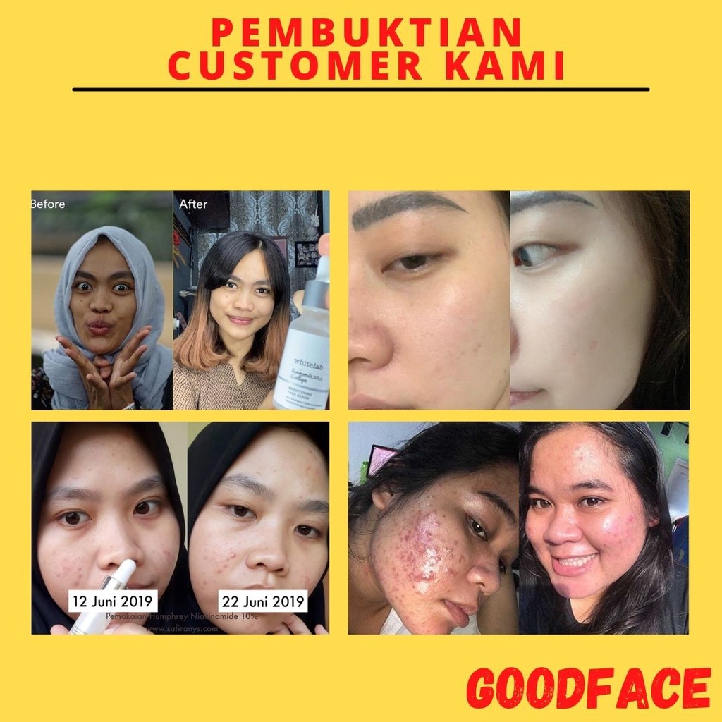 Serum Pencerah Wajah Whitelab Brightening Booster Serum - Niacinamide 5%