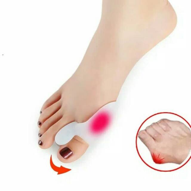 SILIKON GEL IBU JARI KAKI UNTUK HALLUX VALGUS