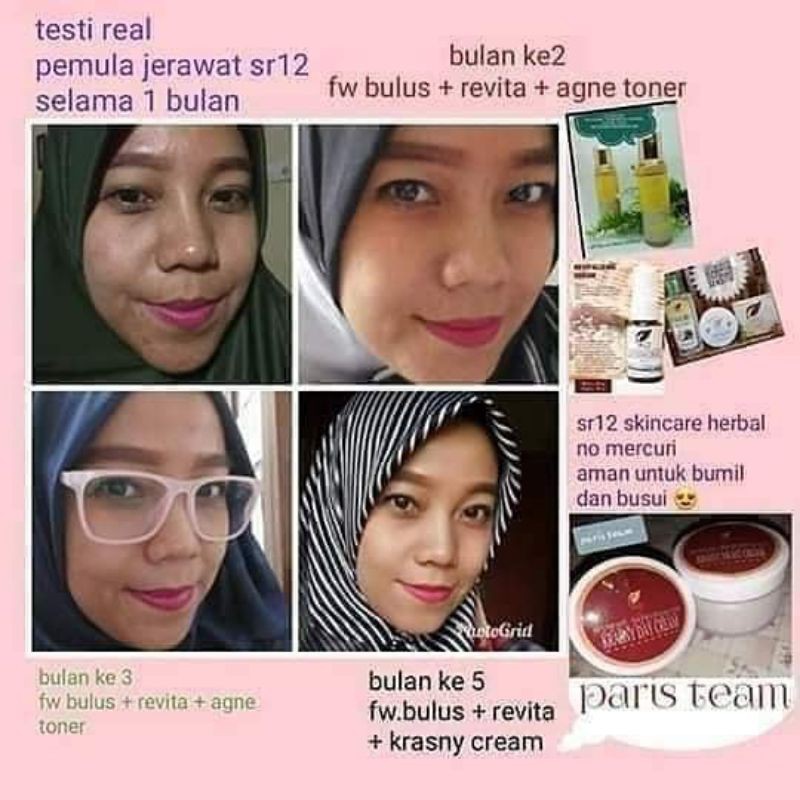 SR12 Krasny Day and Night Cream Set Krim Siang Malam SPF25 Anti Aging Penuaan Dini Mencerahkan Menghilangkan Bintik Hitam Mengobati Jerawat Bisa Untuk Jenis Kulit Kering