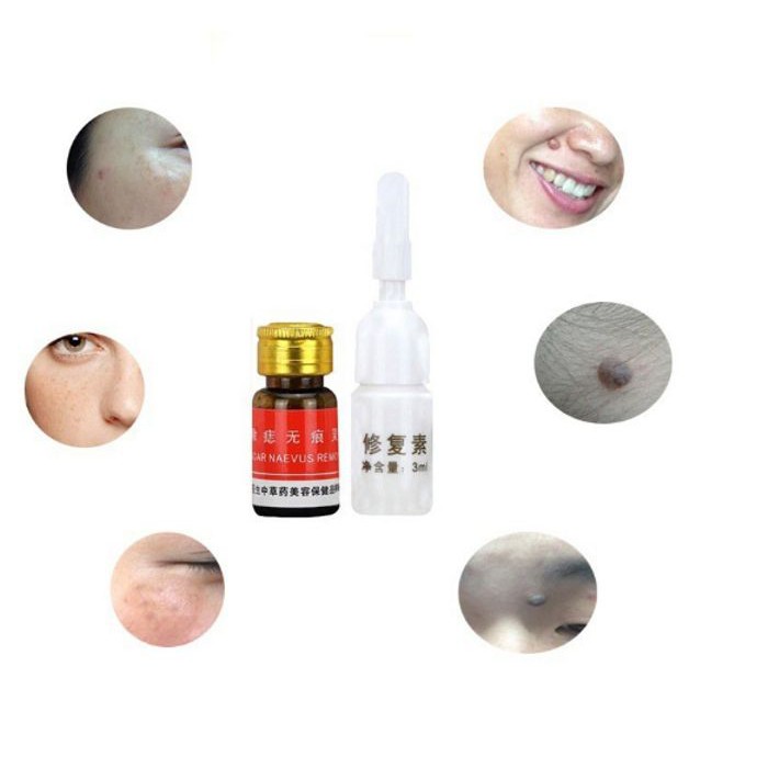 PENGHILANG KUTIL BINTIK BINTIK GELAP KULIT QUALITY IMPORT SKIN SPOT