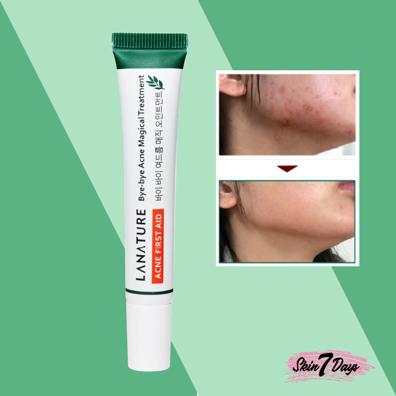 Lanature-Bye-bye Acne Magical magical Treatment  spot cream Hilangkan Jerawat/ LA NATURE ANTI ACNE