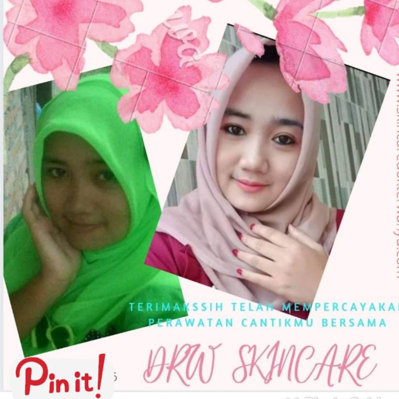 PAKET BODY WHITENING LOTION MALAM LOTION SIANG LULUR PEMUTIH SABUN KOJIC  DRW SKINCARE SURABAYA