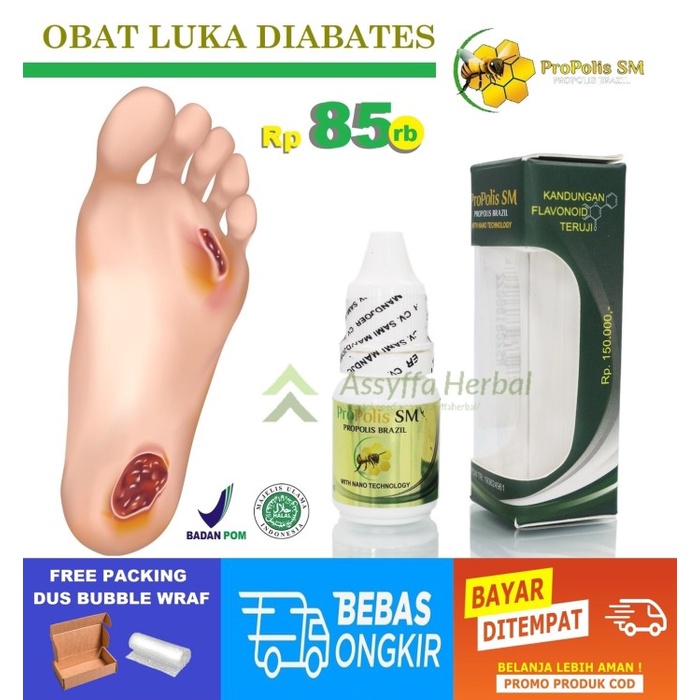 OBAT LUKA DIABETES BERULAT BELATUNG BERNANAH BUSUK BAU DARAH HERBAL TERLARIS