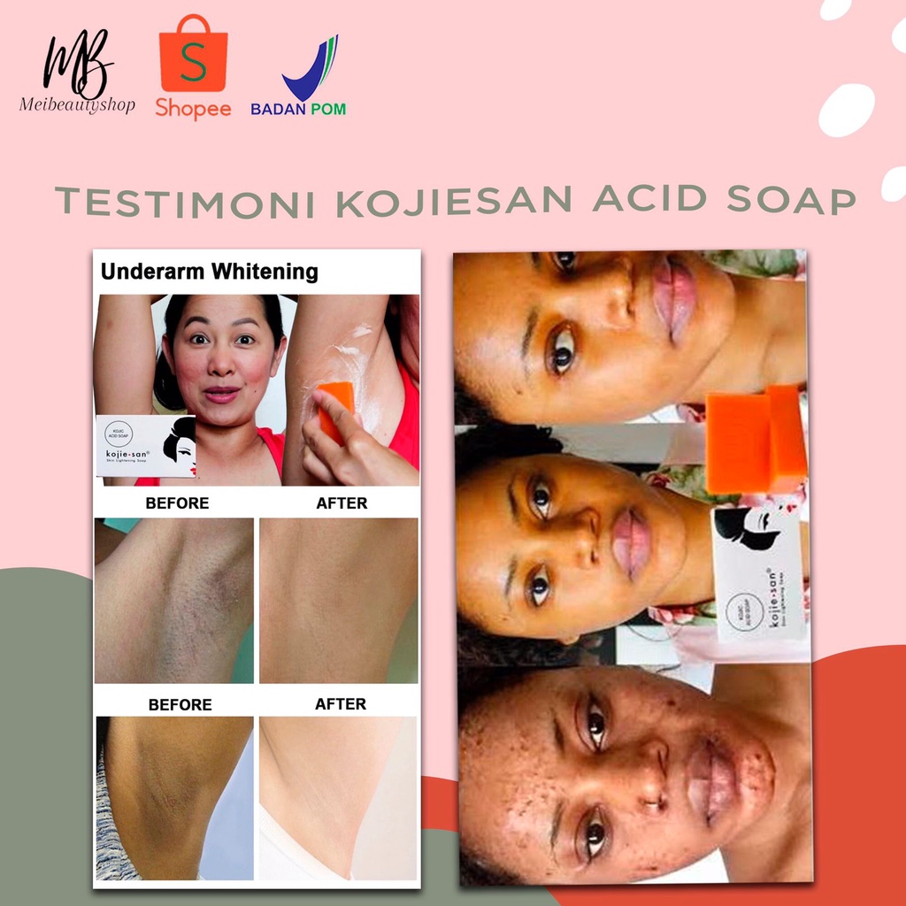 KOJIE SAN Skin Lightening Soap / Kojiesan Soap / Sabun Pemutih