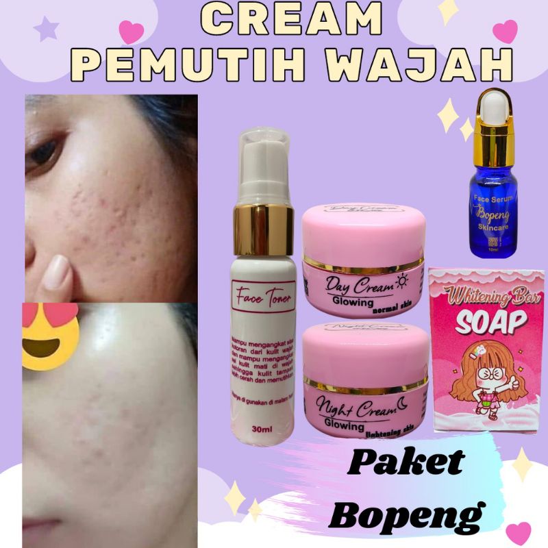Cream pemutih wajah ampuh SKINCARE Cream pemutih wajah TERBAIK dan termurah PAKET BOPENG + SERUM BOP