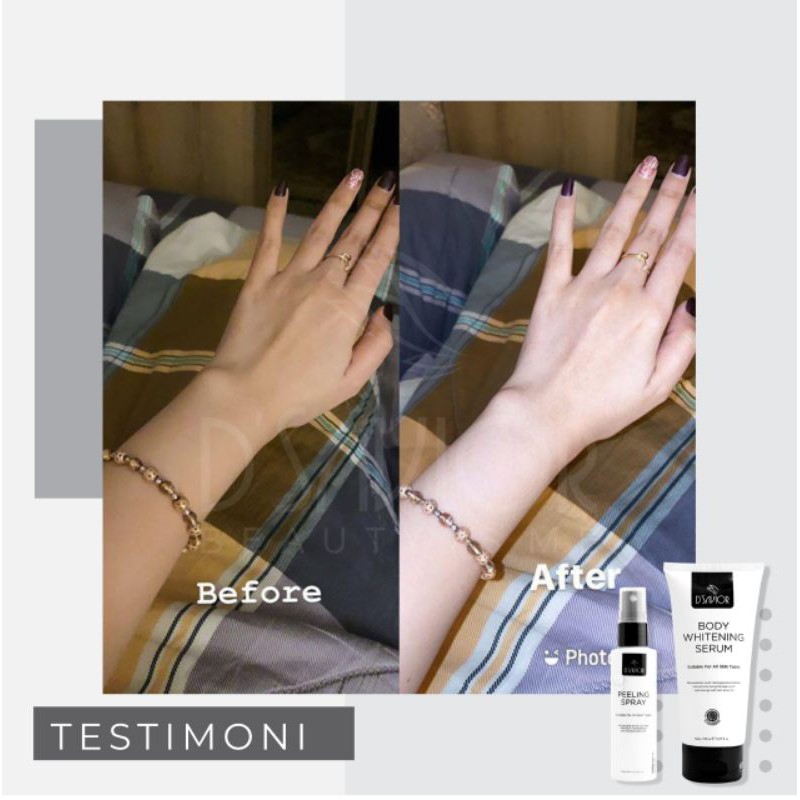 Pemutih badan/Handbody/Pelembab/Penghilang Strechmark/Body Serum D'SAVIOR/Halal BPOM