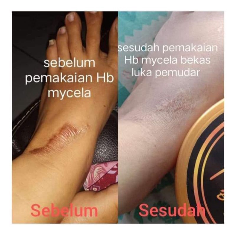 Mycela Body Lotion Collagen