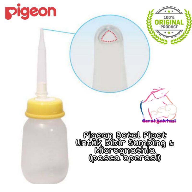 Pigeon Botol Pipet untuk Bayi Bibir Sumbing dan Micrognathia pasca operasi