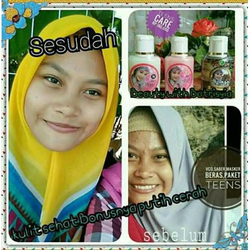 Day &amp; Night Cream Teens care Batrisyia