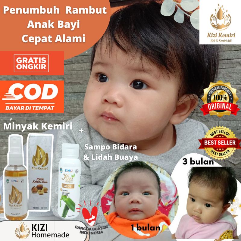 MINYAK KEMIRI PENUMBUH RAMBUT, PENUMBUH RAMBUT BAYI, MINYAK RAMBUT KEMIRI, PERAWATAN RAMBUT, SHAMPO BAYI PENUMBUH RAMBUT, SHAMPOO, SHAMPO BAYI, VITAMIN RAMBUT, PELEBAT RAMBUT, PENYUBUR RAMBUT, PENUMBUH RAMBUT BAYI CEPAT ALAMI