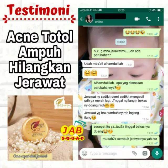 SR12 ACNE TOTOL SR12 / OBAT JERAWAT / OBAT JERAWAT AMPUH / KEMPESKAN JERAWAT AMAN BUMIL &amp; BUSUI