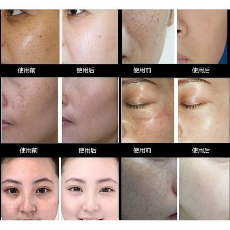 cream bian Lian Wang // cream flek dan jerawat