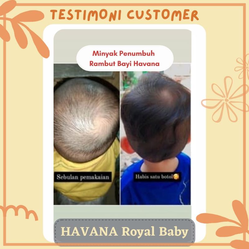 ROYAL BABY Penumbuh Rambut Bayi Dan Anak Serum Hair Vitamin Lotion Penyubur Rambut Bayi Hair Minyak Kemiri Pelebat Rambut BPOM Cepat Tercepat Shampo Sampo Royal Richy Ampuh