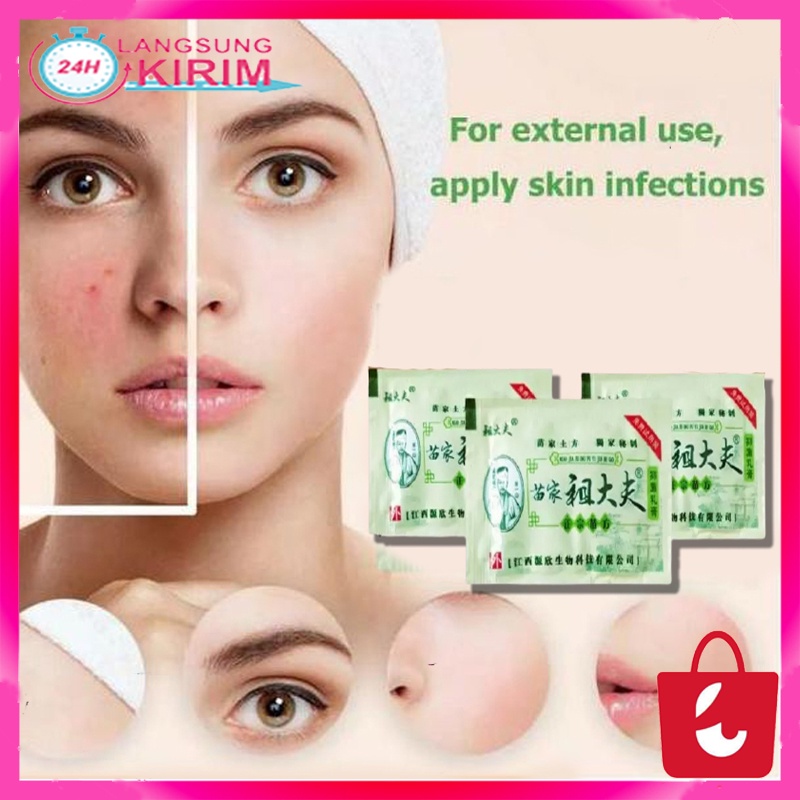 [100% Ampuh] Salep Kulit Eksim Zudaifu Ampuh Mengobati Gatal Alergi Kulit Jamur Kadas Kutu Air &amp; Gigitan Serangga Perawatan Kulit Obat Herbal Cina Krim Kaya Akan Ekstrak Herbal Essence Produk Antibakteri Relief Gatal Eksim dermatitis