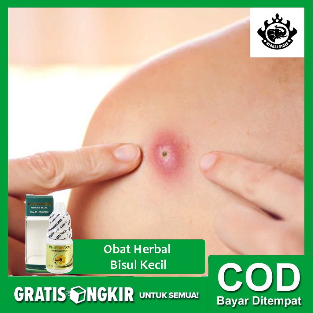 

Obat Herbal Bisul Kecil, Cenang, Benjolan Bernanah di Kulit Propoli SM - HALAL Legal BPOM - Bisa COD