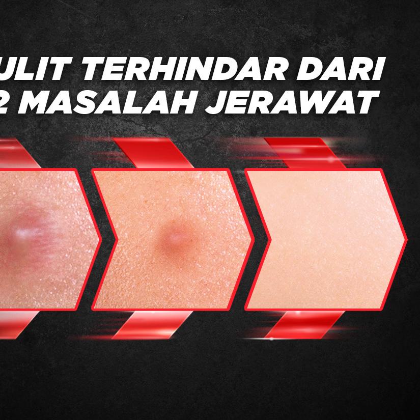 "♔ Garnier Men Acno Fight Acne Fighting Brightening Serum Cream Skin Care - 40 ml (Serum Wajah Pria)