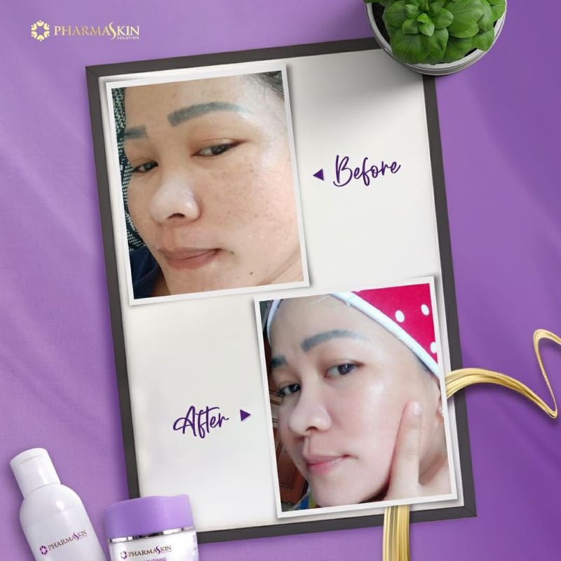 Paket  Flek Lengkap  Pharmaskin Solution-1