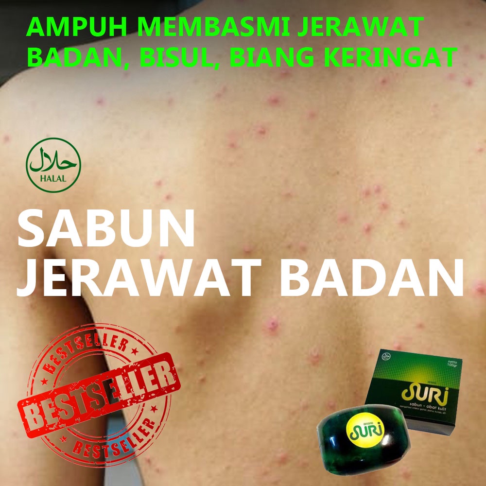 Penghilang Jerawat Biang Keringat Punggung - Sabun Suri