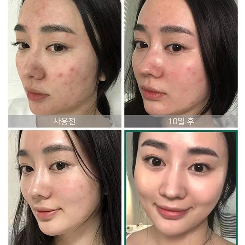CUCI GUDANG Some By Mi 30 Days AHA BHA PHA Miracle Toner Serum Wajah Exfoliating Serum