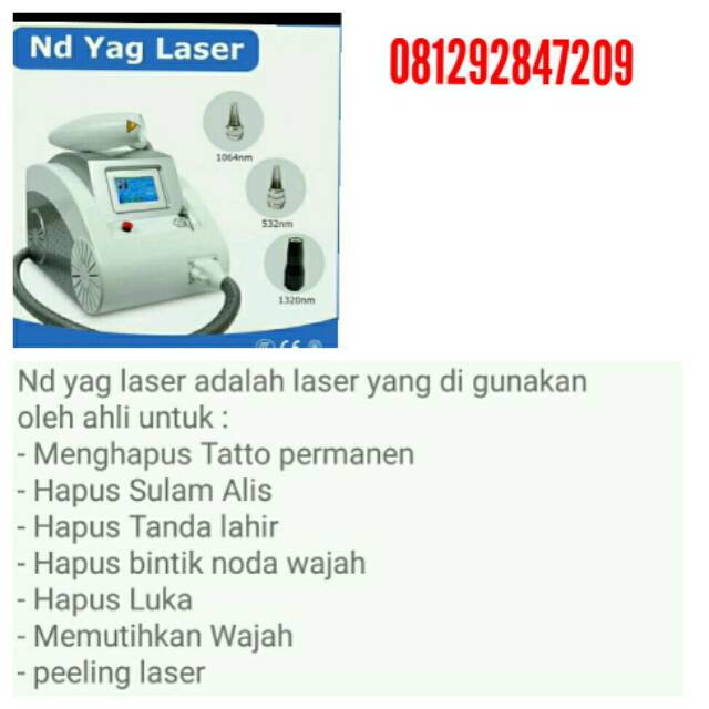 Laser nd yag hapus tato