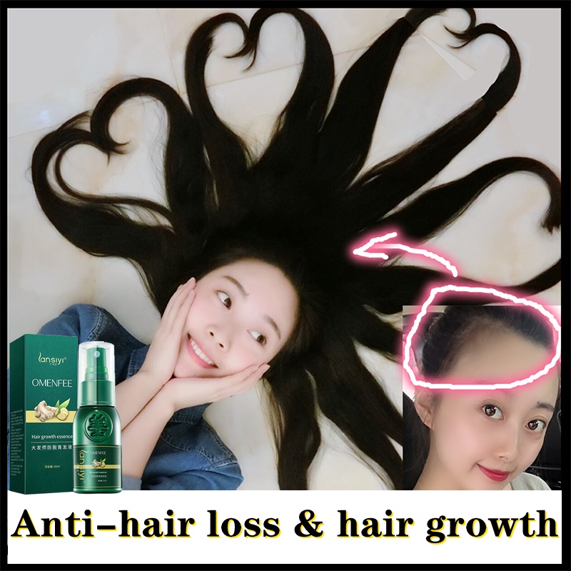 pertumbuhan rambut Hair Growth Essence Esensi Semprotan jahe 30ml Hair Treatment Shampoo Botak Rontok germinal rambut Perawatan Hair Care Efektif Menumbuhkan Rambut