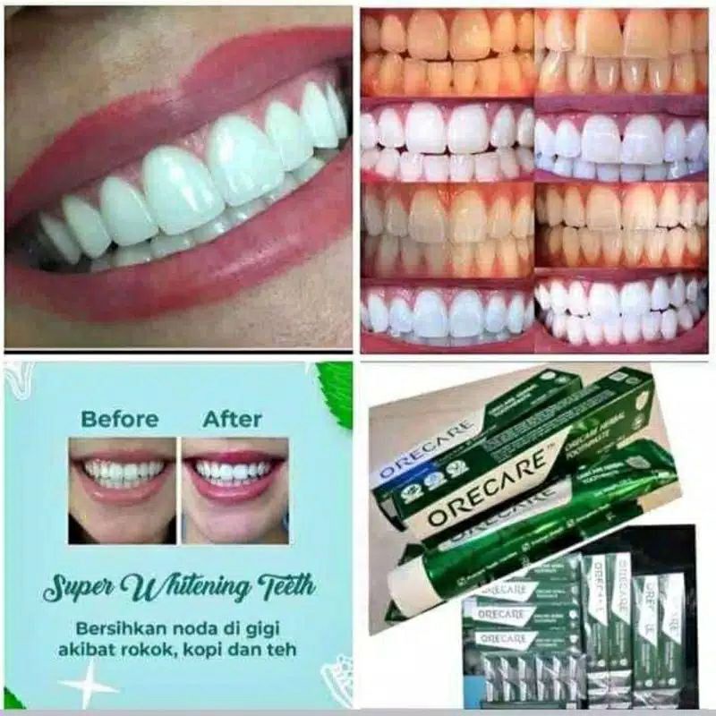 ORECARE SUPER - WHITENING TEETH