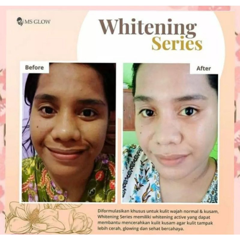 Paket Whitening + Red Jelly Lactobacillus || MS GLOW FREE POUCH