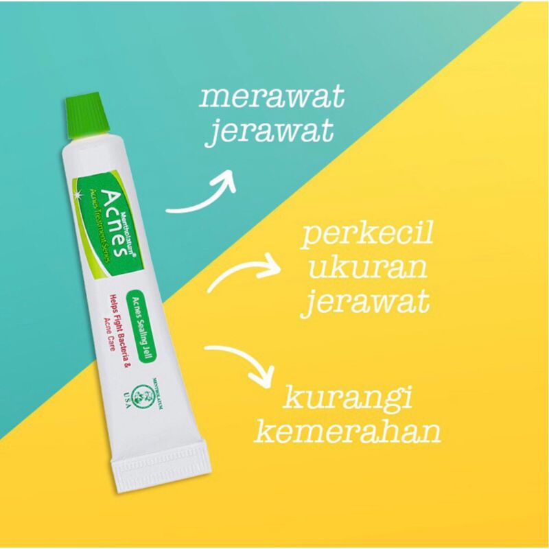 `ღ´ PHINKL `ღ´ a̳c̳n̳e̳s̳ Acnes Sealing Gel mengobati jerawat flek menghitam