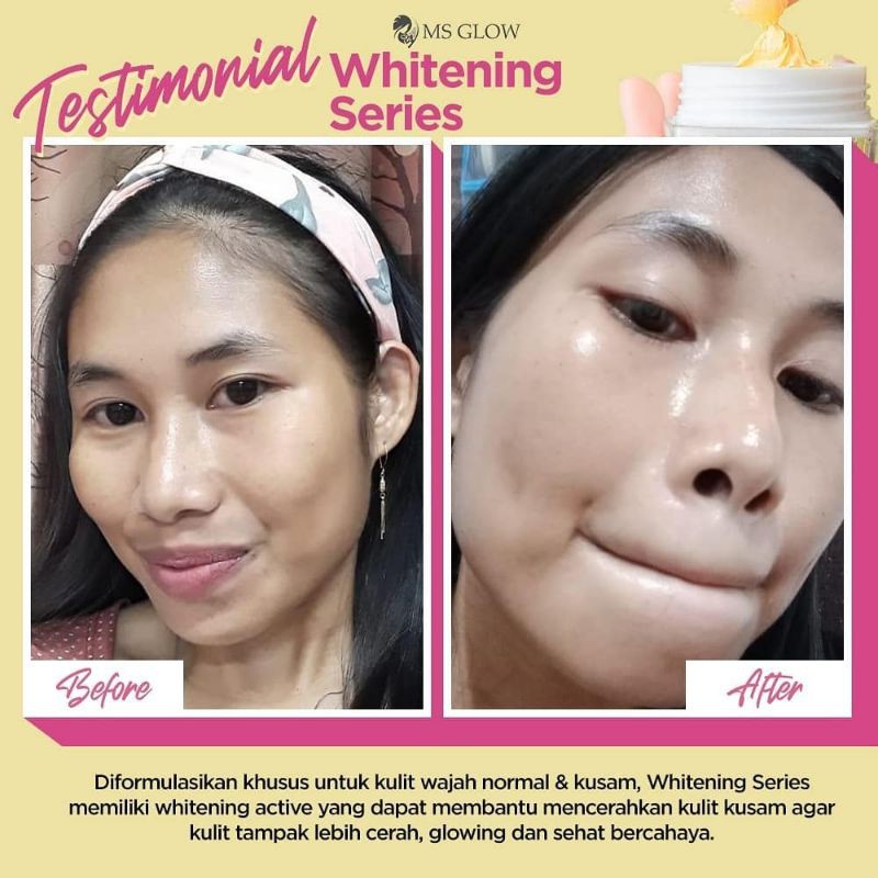 Ms Glow Paket Whitening Free Pouch