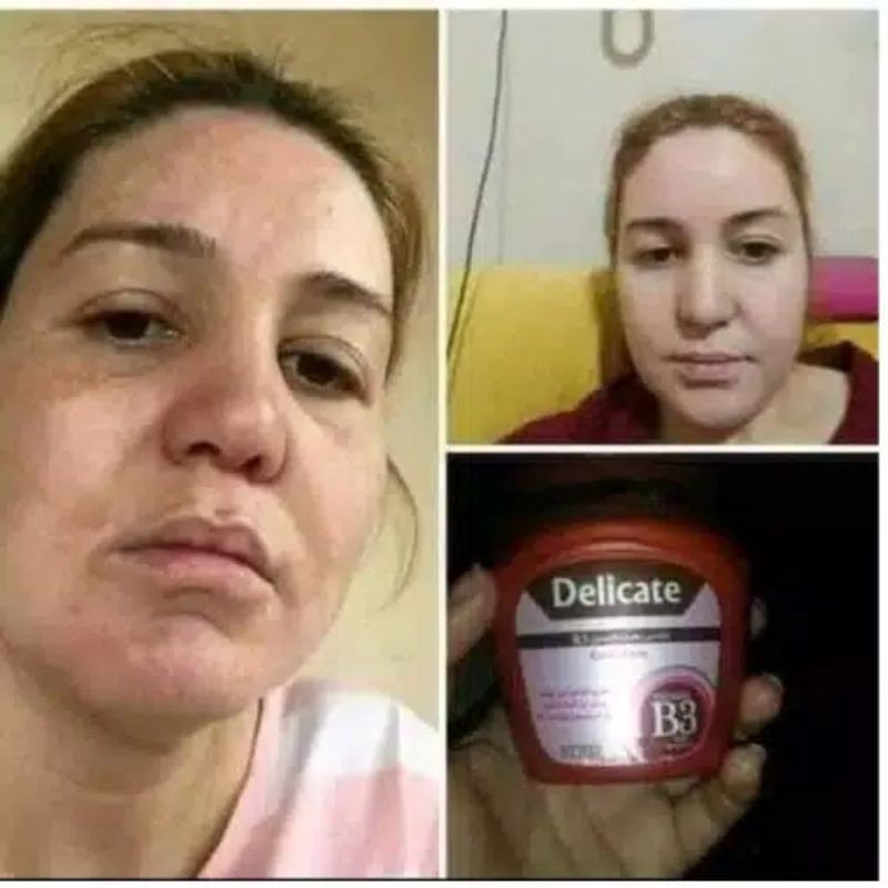 DELICATE VITAMIN B3 MY WAY