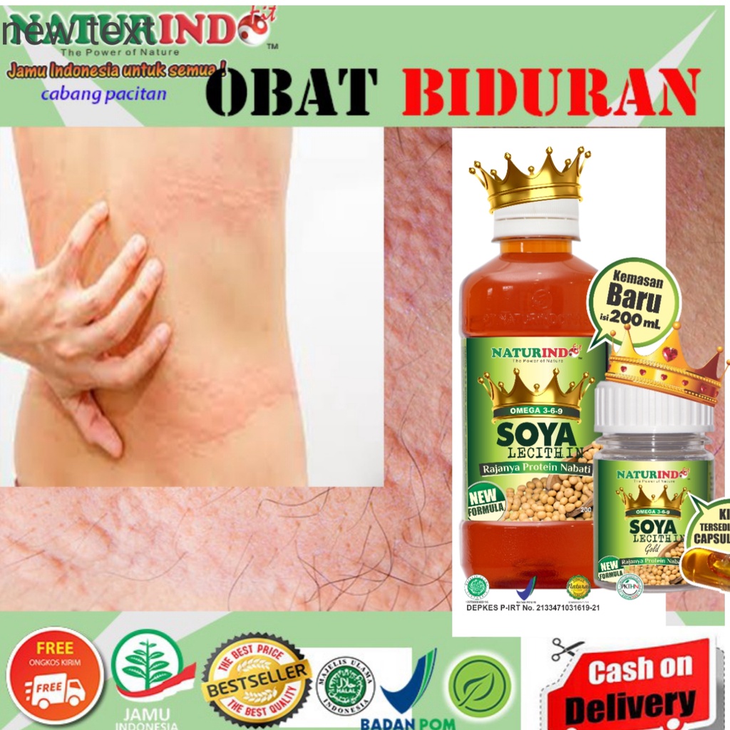 OBAT HERBAL GATAL GATAL BIDURAN BRUNTUSAN DI BADAN HERBAL AMPUH NATURINDO BISA COD