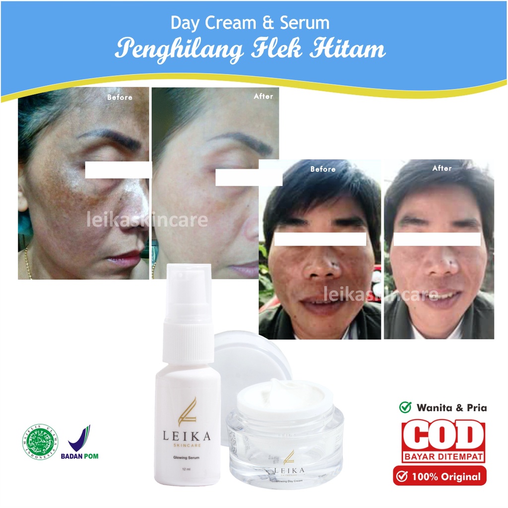 Penghilang Flek Hitam Membandel PAKET 2 in 1 Serum Penghilang Flek Hitam Cream Flek Hitam Membandel 