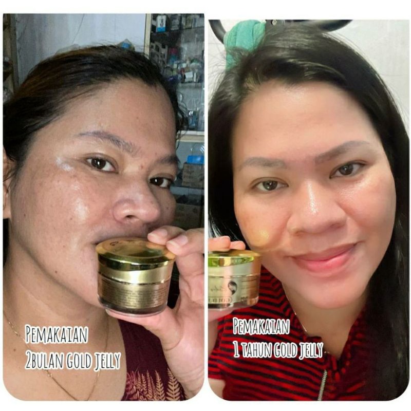 paket glowing gold jelly dan brithening shop KEDAS beauty ORI 100% geratis gift cermin dan gantungan kunci-2