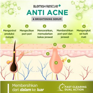 ★ BB ★ AZARINE Anti Acne SERIES - Cleansing Foam 60ml - Acne Spot Gel 15gr - Anti Acne Serum 20ml
