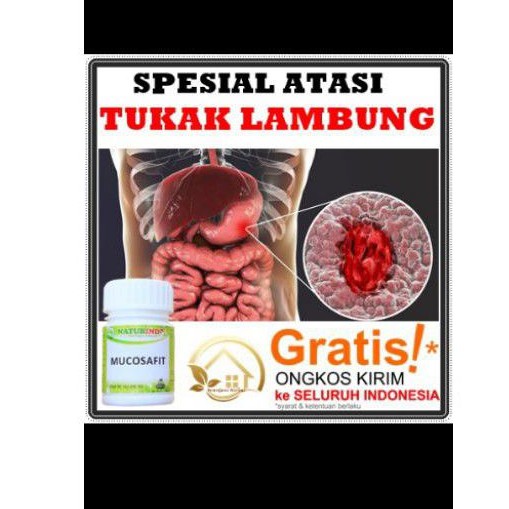 

Herbal Spesialis Penyakit asam lambung (Ampuh)