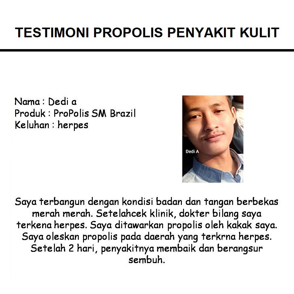 Obat Herbal Jamur Kulit, Salep Penghilang Gatal Gatel di Kulit, Jamuran, Kudis, Kurap, Herpes, Eksim, Panu, Hapur, Hitam di Selangkangan-1