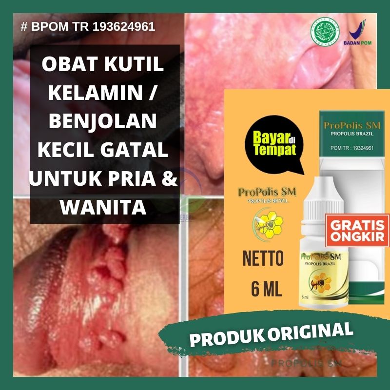 [ SUDAH ADA TESTIMONI  ] Obat Gatal Testis Pria Tradisional, Penghilang Gatel Buah Zakar Pada Pria, 